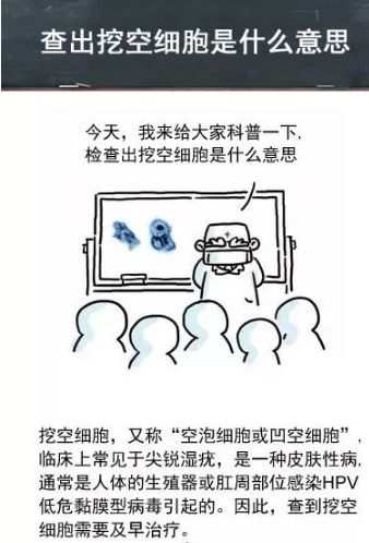 病检查出挖空细胞是什么意思